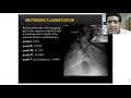 Ref:dJjb0sHEXtg Meyerding's staging i spondylolisthesis