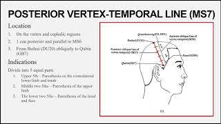 Uj Online Lectures20 Scalp Acupuncture