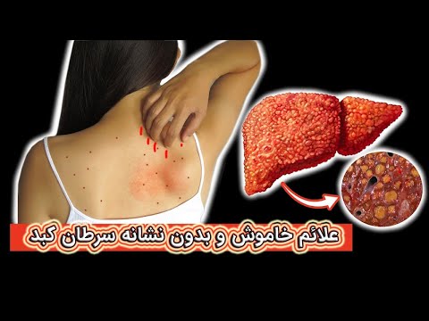 تصویری: چه علائمی از زودیاک برای عقیق مناسب است