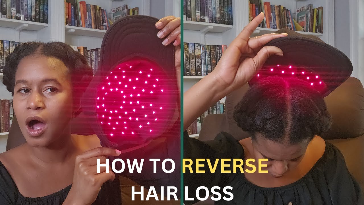 Low Level Laser Therapy For Hair Loss | Does it WORK? SCIENLODIC REVIEW