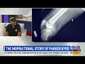 CAF Co-founder sits with Lauren Phinny of KUSI to speak about Parker Byrd