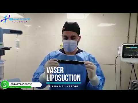 شرح مبسط عن آلية عمل جهاز الفيزر 