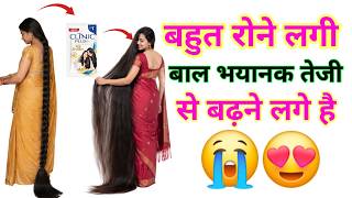 अरे वा 😍,मैंने ये 2 चीज़ें, शैंपू में मिलाई,मेरे बाल 100 गुना तेजी से बढ़ने लगे,
