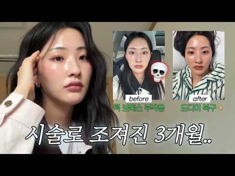 직장인 VLOGㅣ예뻐지려다 해골 바가지 됨☠ㅣ보톡스 부작용 복구 여정 (강남은 다르네;)✨ㅣ3시간 자고 출근🫠ㅣ봄 출근룩ㅣ봄동 비빔밥ㅣ이 집 모르면 청주 사람 아님..#닭발맛집 thumbnail