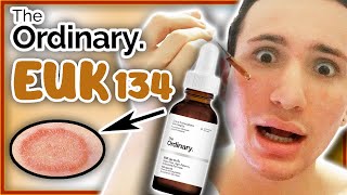 the ordinary euk serum