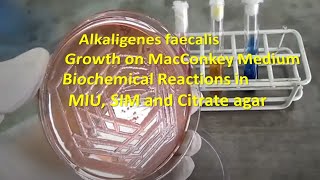 Alkaligenes faecalis Colony Morphology on Macconkey agar and Biochemical Reactions Demonstration