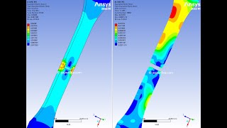 FEA of Tensile Pulling Joined Plastic Probes Until Breakage Occurs - ANSYS WB Explicit Dynamics
