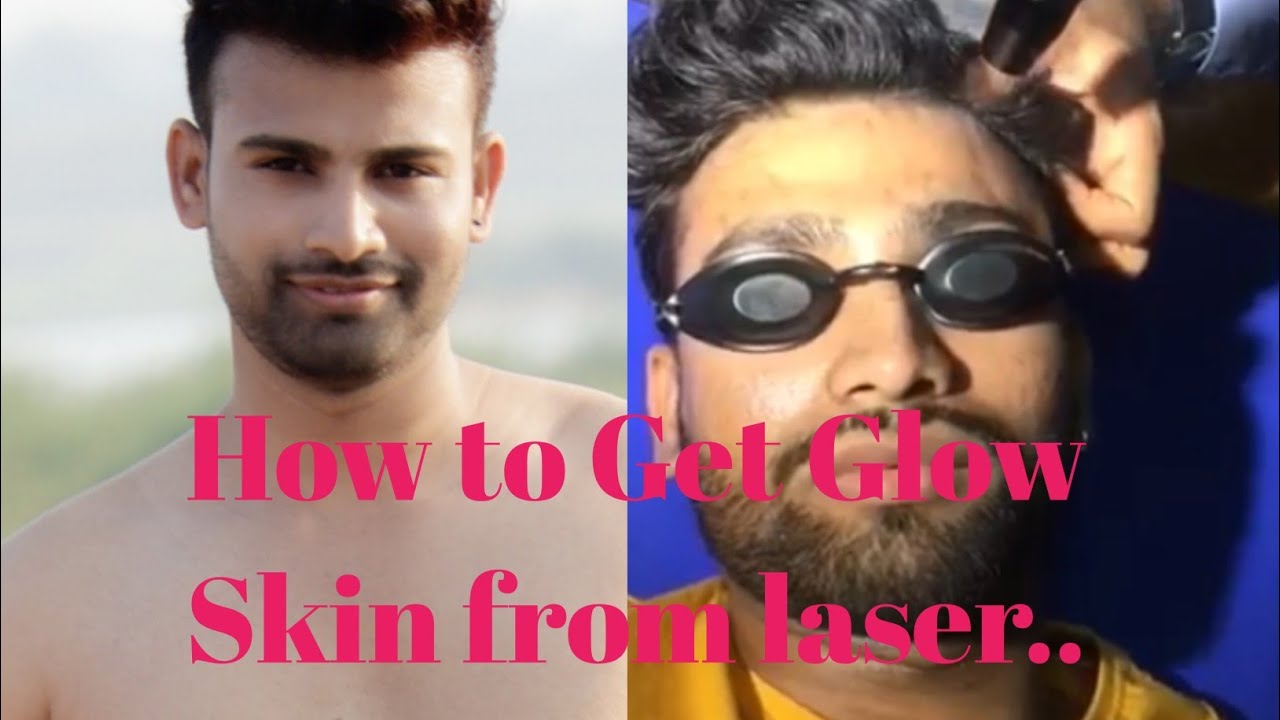 How to get glow face from laser Kannada men's grooming Kannada