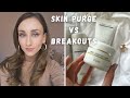 SKIN PURGE VS BREAKOUTS | Biologique Recherche | Zlatina Stoyanova