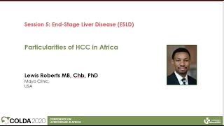 Particularities of HCC in Africa | Lewis Roberts, MB, Chb, PhD