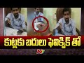 Hospital uses Fevikwik instead of stitches for child's head injury in Telangana