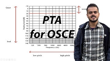 Hearing Tests - Pure Tone Audiometry (PTA) - Different Audiograms for OSCE