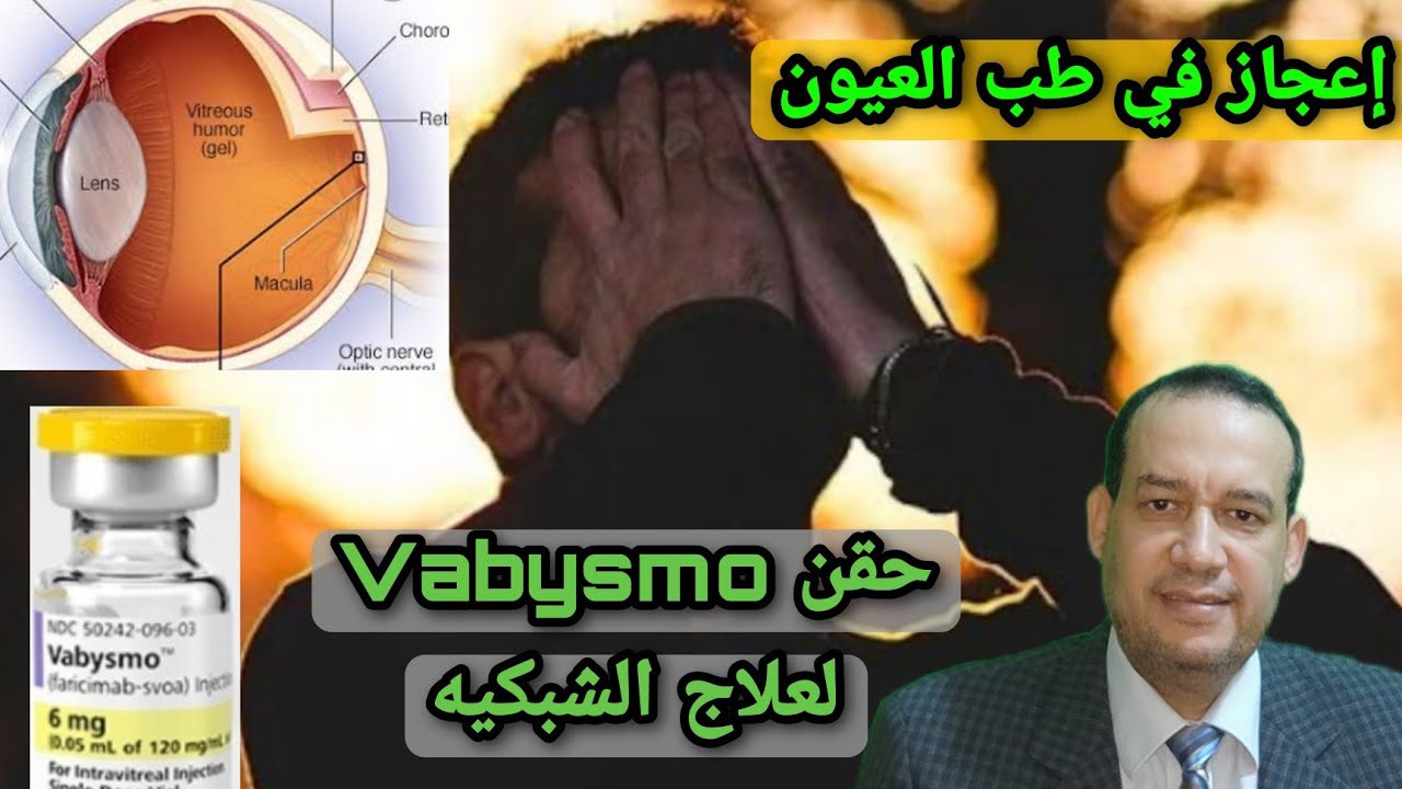 اعجاز في طب العيون فابيسمو Vabysmo حقن علاج ارتشاح الشبكيه/نزيف الشبكيه/التنكس البقعي و ضمور الشبكيه