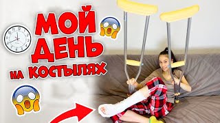 ПЕРВЫЙ ДЕНЬ в ГИПСЕ👉 ХОЖУ на КОСТЫЛЯХ😰