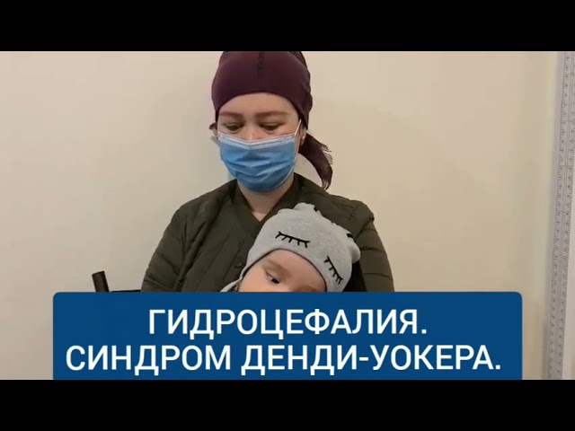 ГИДРОЦЕФАЛИЯ. СИНДРОМ ДЕНДИ-УОКЕРА. БОШ НЕГА ЯНА КАТТАЛАШДИ???