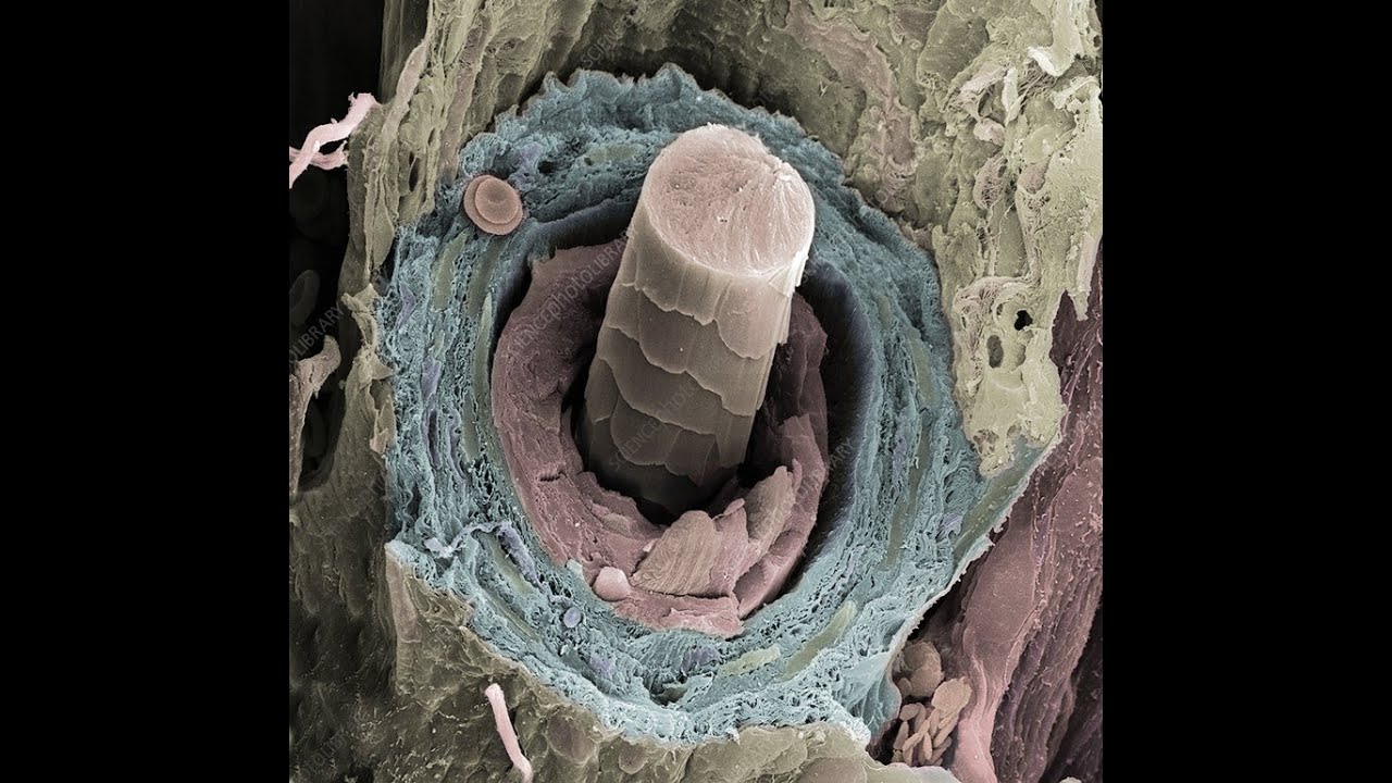 Самые тяжелые организмы. Волосяной фолликул микрофотография. Волос под микроскопом. Человеческий волос под микроскопом. Волос в микроскопе.