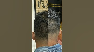 Kiểu tóc cho anh em nhiều sẹo. hớt tóc cao sát, cắt húi cua , Kiểu xăm tóc che sẹo ý. #xămtóc