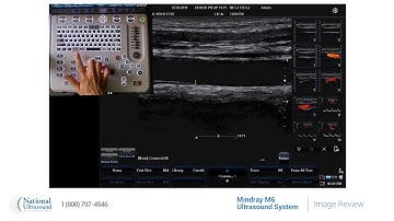 Mindray M6 Ultrasound Machine - How to view images