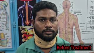 Cervical Disc problem cured in Nadicare 9666779929
