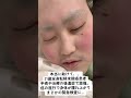 生きる事が絶望的…一生寝たきり。生存率１割未満。生きられるように前向いて闘い続けます！！皆さん良ければ最期まで信じて応援宜しくお願い致します🥹🙇#骨肉腫 #05 #ありがとう#いいね #おすすめ
