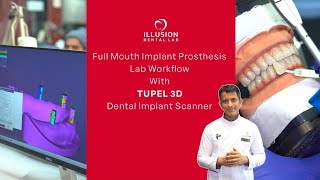 Watch How TUPEL 3D Implant Photogrammetry Scanner Ensures Passive Fit in Full-Mouth Implant Cases