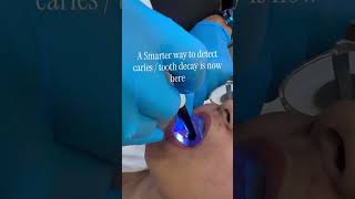 Early Cavity detection device - Modern dentistry🦷!!!!