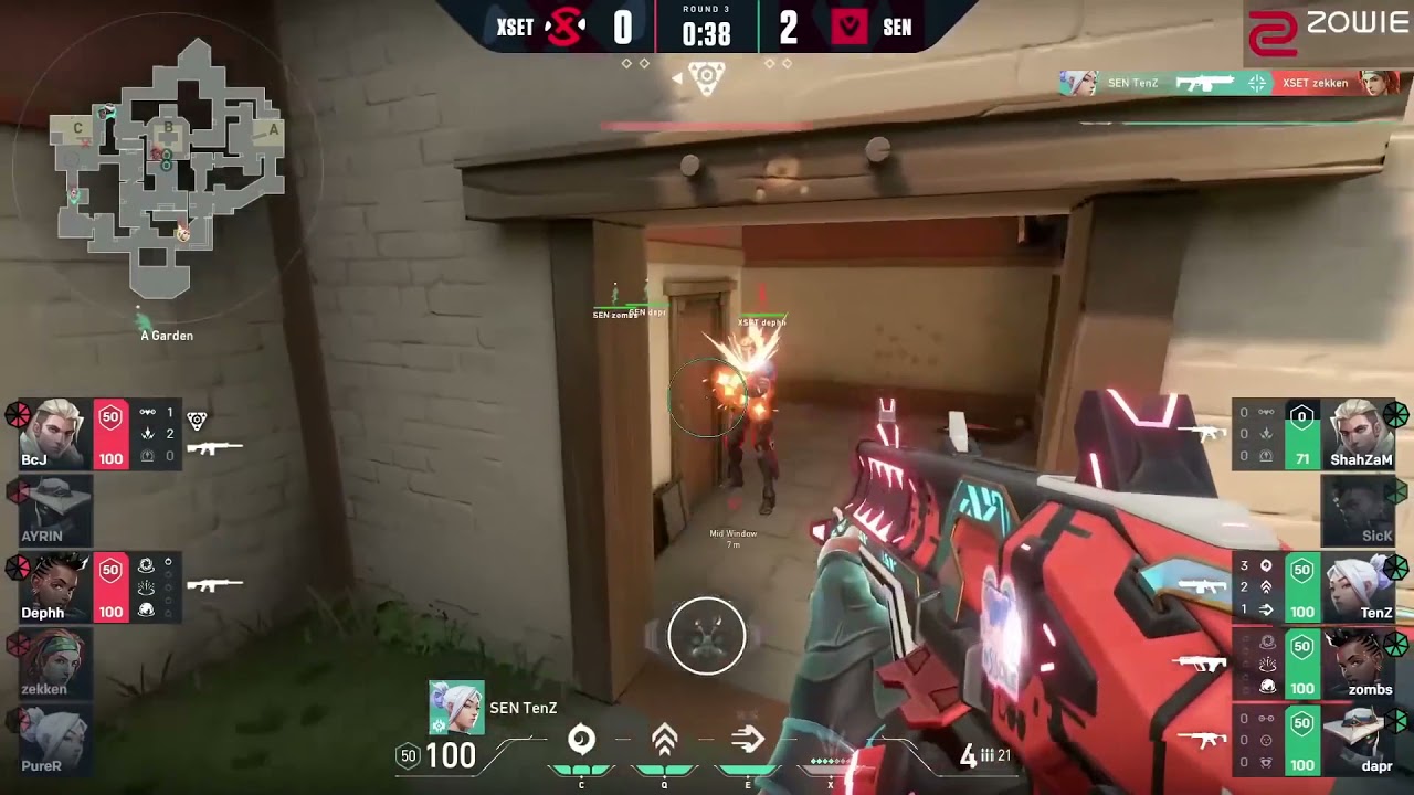 SEN TenZ triple kill flank | Sentinels vs XSET   VCT Stage 3:  NA Challengers 1