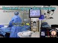 Cataractcoach 1223 learn how to set up your phaco machine