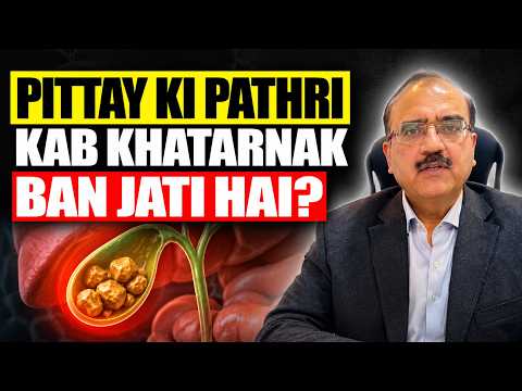 Kya Pittay Ki Pathri Ka Ilaj Sirf Operation Hai? - Gallbladder Stone Risks & Surgery thumbnail image