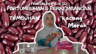 Download lagu PRATIKUM IPA DI SD| PERTUMBUHAN DAN PERKEMBANGAN BIJI KACANG MERAH