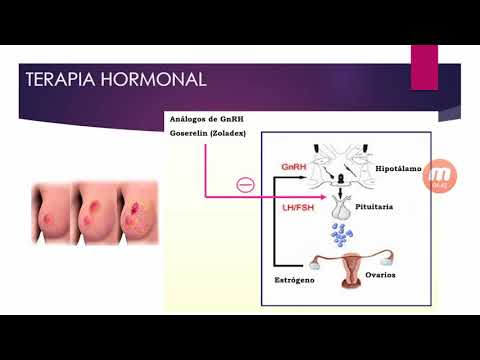 Vídeo: Endocrinología Y Terapia Hormonal En El Cáncer De Mama: Una Nueva Visión De La Función Del Receptor De Estrógenos α Y Su Implicación Para La Resistencia A La Terapia Endocrina En E