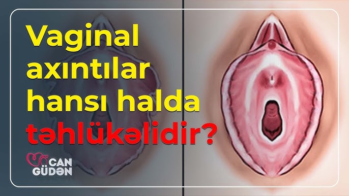 Oshxonada etagini kotarayotgan etuk ayolni onlayn tomosha qiling