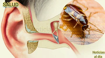 ¿Qué tan común es la cucaracha en el oído?