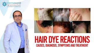 Hair dye reactions : Causes, Diagnosis, Symptoms and Treatment