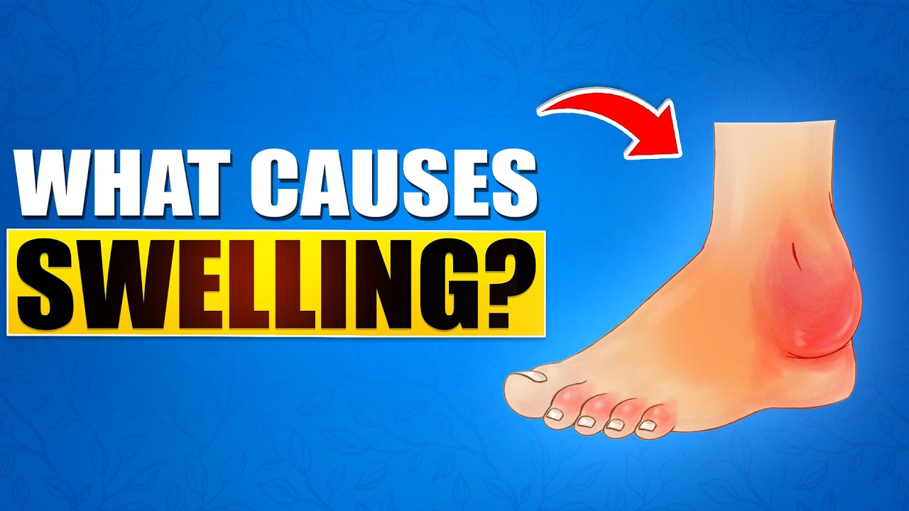 Understanding Swollen Ankles Feet Top 10 Causes Explained Remedies Understanding Swollen Ankles Feet Top 10 Causes Explained Remedies