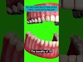3d reconstruction in post oral cancer surgery a game changer 