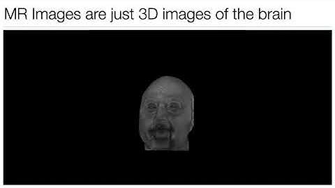 Neurohackademy 2020: Introduction to the Geometry and Structure of the Human Brain