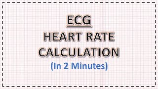 ECG: Heart Rate Calculation | In 2 minutes | ECG Interpretation screenshot 5