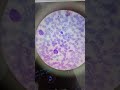 #EOSINOPHILIA (Microscopy)