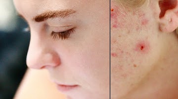 The Power of Frequency Separation with Affinity Photo + Free Project