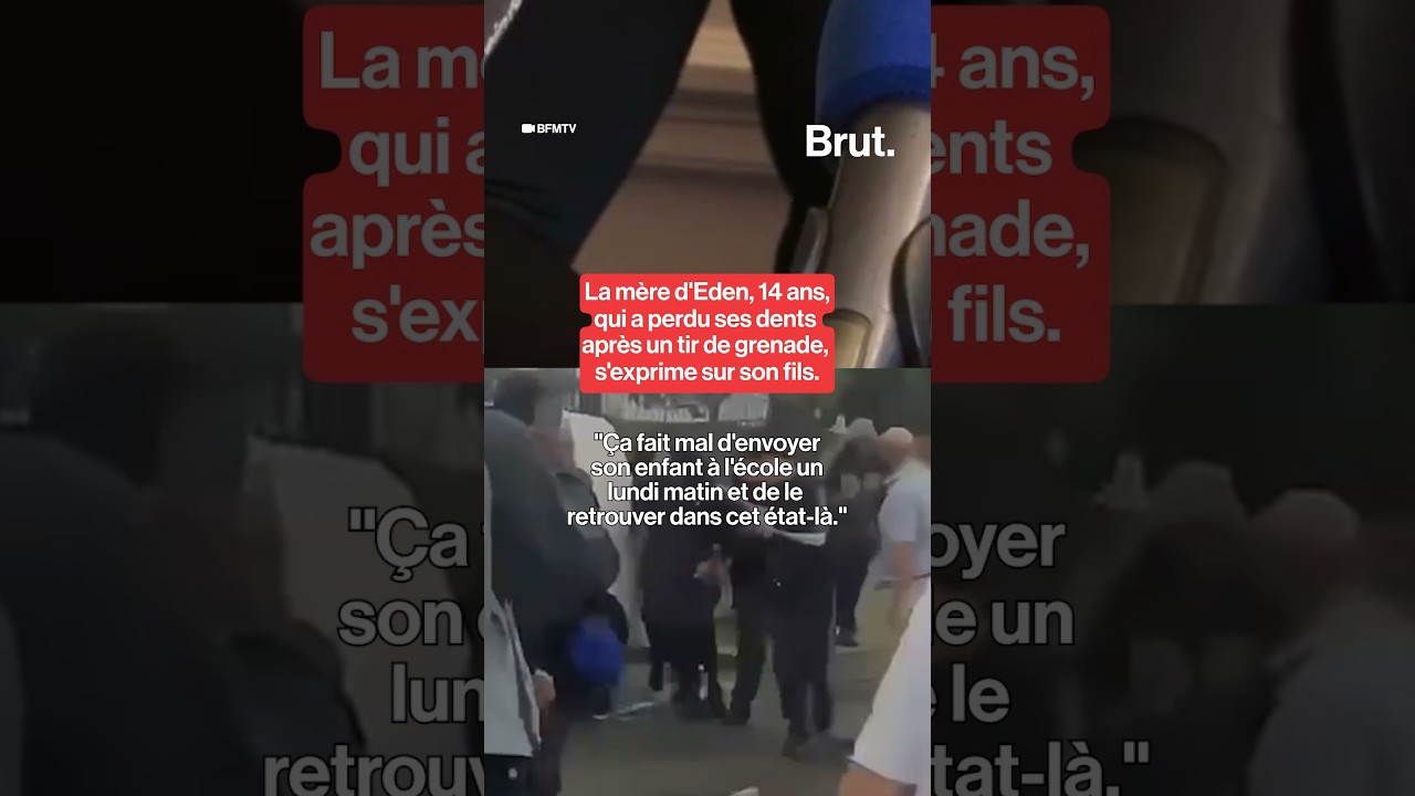 La mère d'Eden, 14 ans, qui a perdu ses dents après un tir de grenade, s'exprime sur son fils.