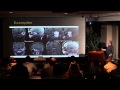 Designing an Anterolateral Skull Base Approach: Infratemporal Fossa Tumors Approach