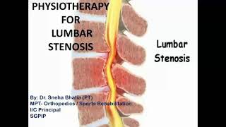 Physiotherapy for Lumbar spine stenosis! #StayHome and study #WithMe