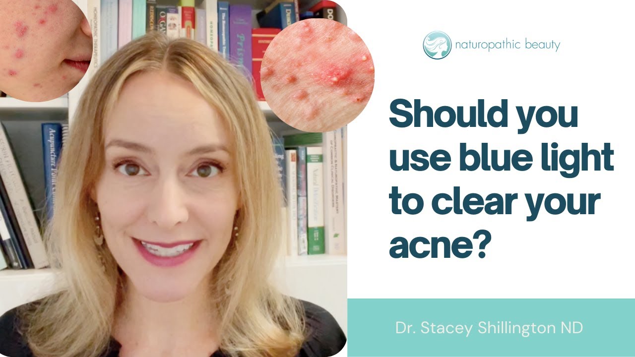 Blue LED light therapy for acne YouTube