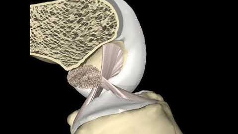 A 3D ACL & PCL View during Knee-Flexion-Extension Kinematics ... https://youtube.com/c/TimHewettPhD