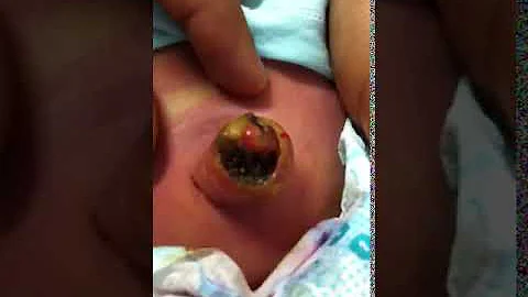 Qual a importância do corte da cauda e como é feito esse procedimento?
