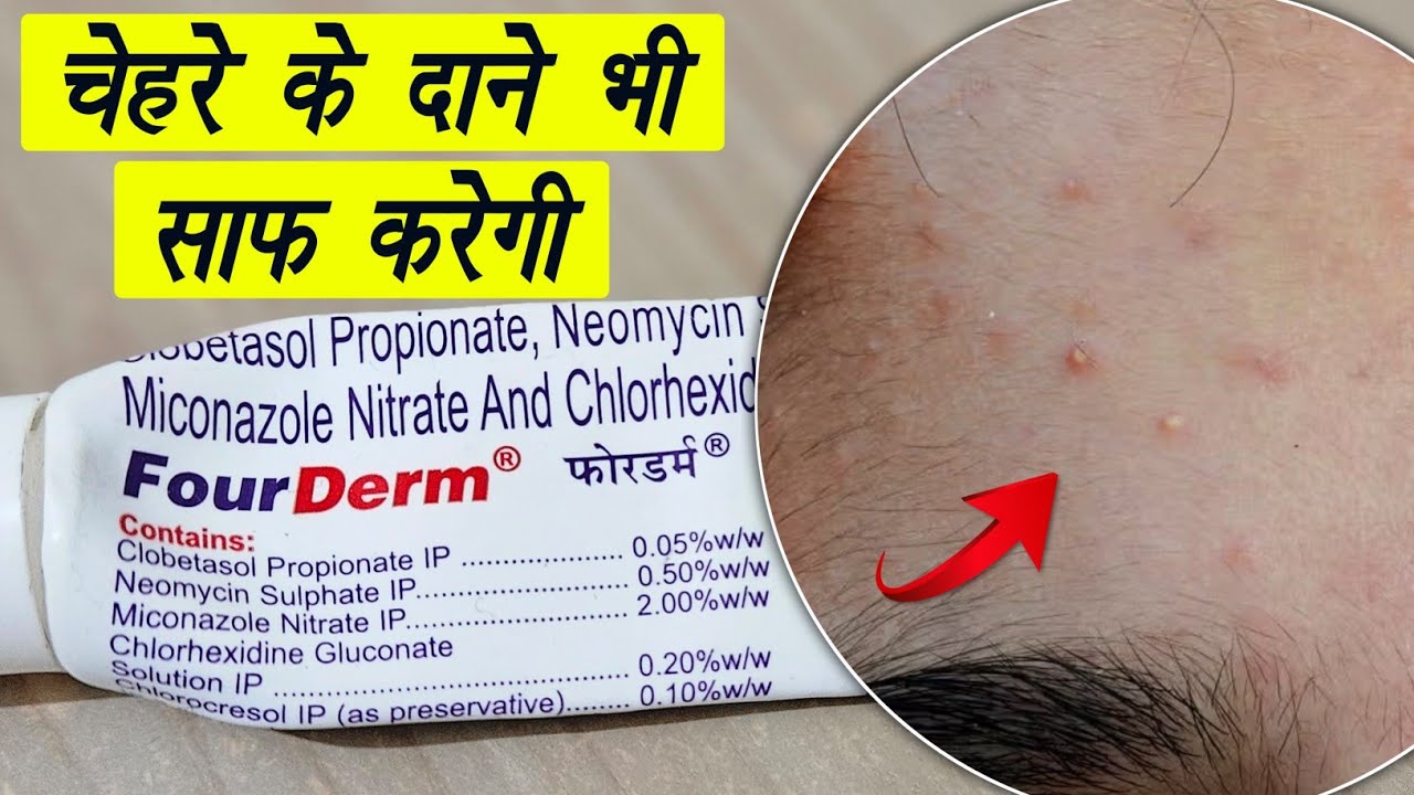 fourderm cream • uses, benefits, Side Effects | Detail Review