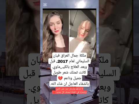 ملكة جمال العراق فيان السليماني لعام 2017 قبل وبعد العلاج بالكيماوي