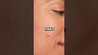 The Secret to Korean "Baby Face" Skin:Extreme Sun Protection #KoreanSkincare #KBeauty #SunProtection
