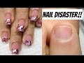 ♡ How to: Gelnails on Nailbiter